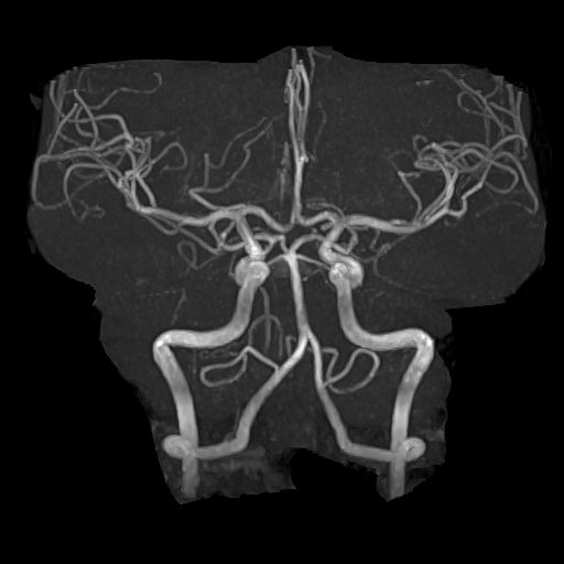 脳ドックの流れ