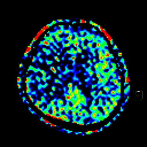 脳ドックの流れ
