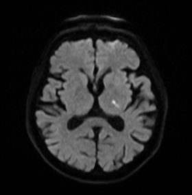 脳ドックの流れ