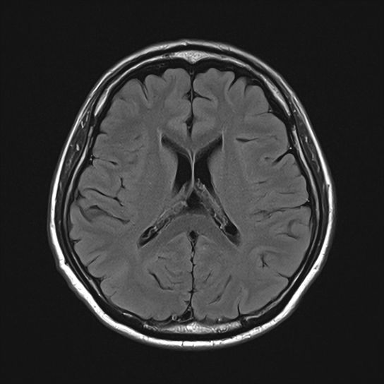 脳ドックの流れ