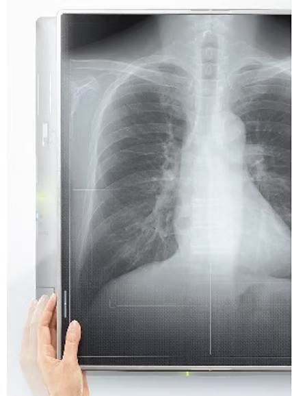 フラットパネルエックス線撮影システム