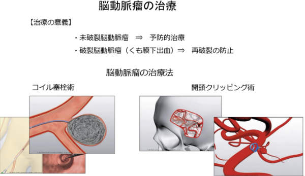 脳神経外科