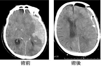 脳神経外科