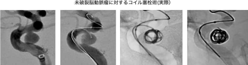脳血管内治療科
