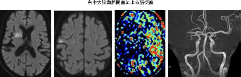 脳血管内治療科