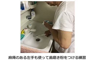 麻痺のある左手も使って歯磨き粉をつける練習